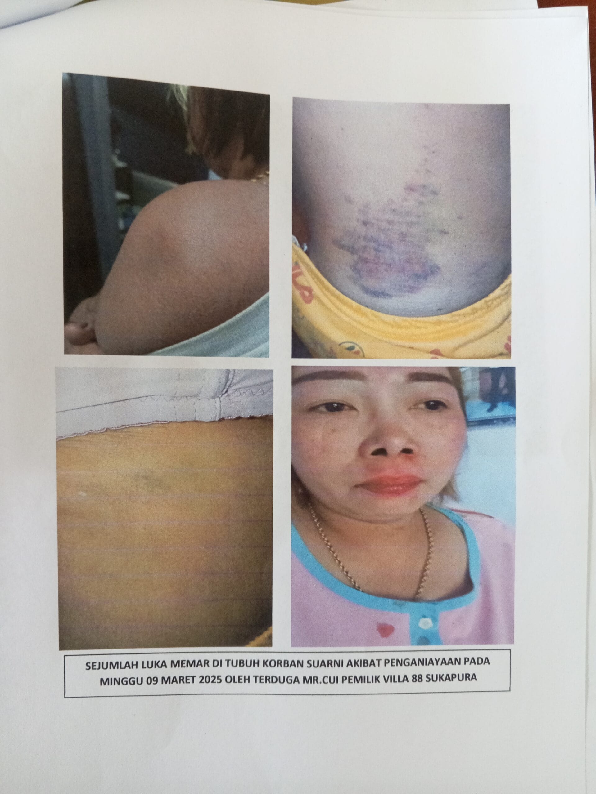 Aliansi Aktivis Probolinggo Desak Polisi Usut Tuntas Dugaan Penganiayaan Terhadap Suarni Aliansi Aktivis Probolinggo Desak Polisi Usut Tuntas Dugaan Penganiayaan Terhadap Suarni