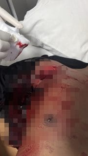 Siang Mencekam di Komodo, Empat Personel Brimob Bersimbah Darah Usai Diserang dengan Sangkur