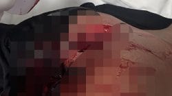 Siang Mencekam di Komodo, Empat Personel Brimob Bersimbah Darah Usai Diserang dengan Sangkur